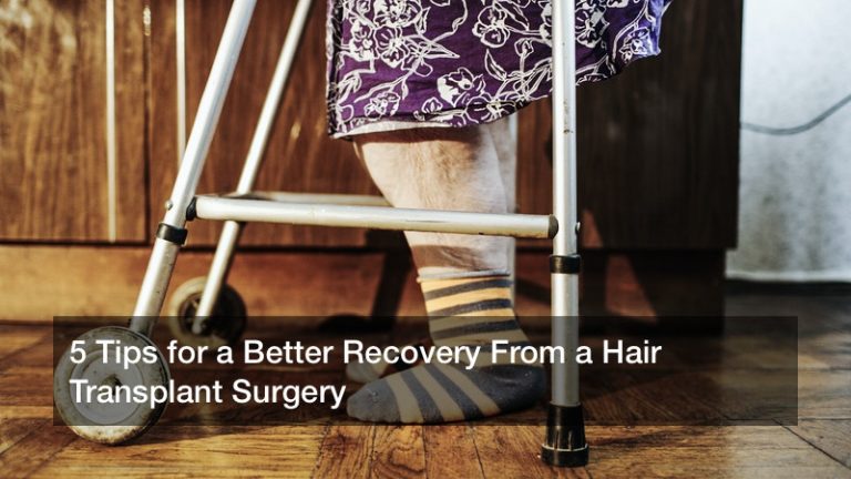 5 Tips for a Better Recovery From a Hair Transplant Surgery