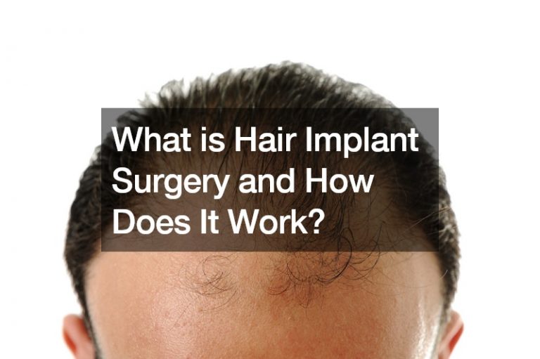 What is Hair Implant Surgery and How Does It Work?