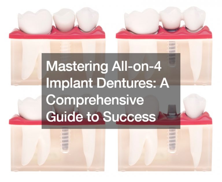 Mastering All-on-4 Implant Dentures  A Comprehensive Guide to Success